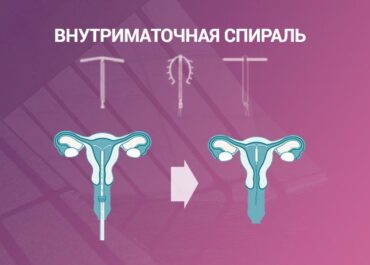 Если спираль, то там надо читать правило 20 раз